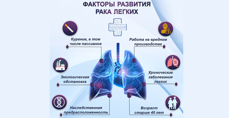 Факторы развития рака лёгких